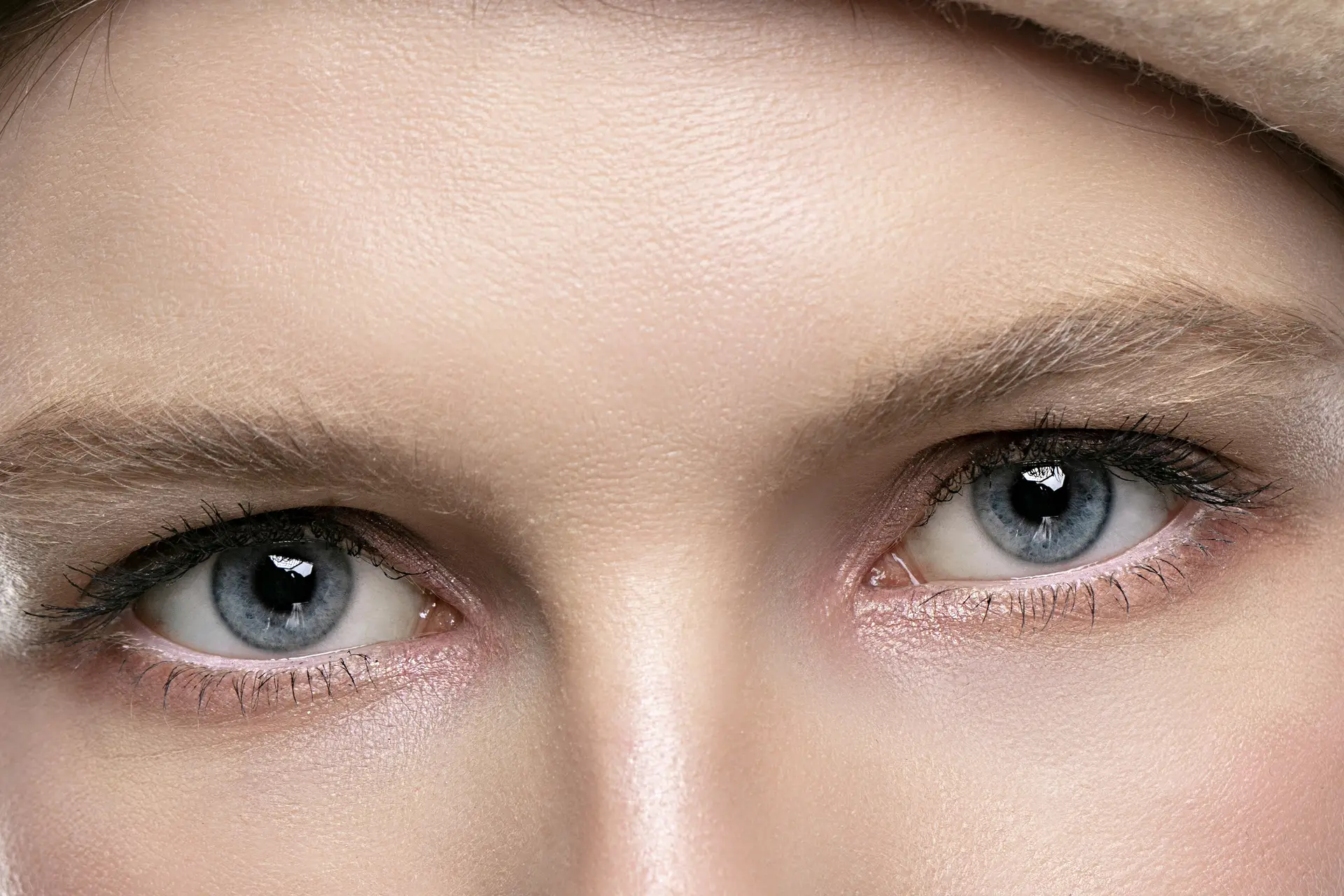 Upper Eyelid Surgery
